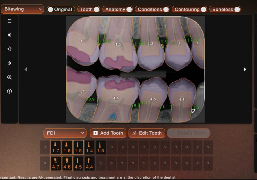 Análisis IA Detalle