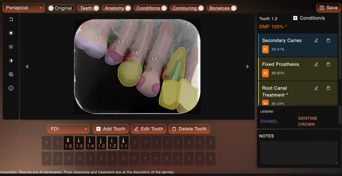 Análisis IA Panorámica